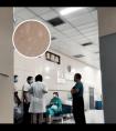医用308激光多少钱一台家用