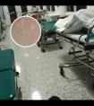 白癜风医院光疗仪啥样子